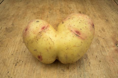Zo profiteer je van je imperfecties
