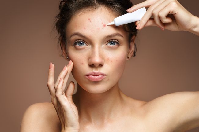 Appdate: Acne tegengaan met een dagelijkse selfie